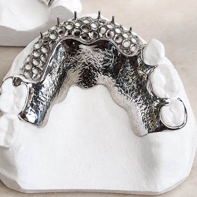 Châssis chrome-cobalt de prothèse partielle sur modèle en plâtre