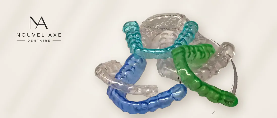 Gouttières thermoformées bleue, verte et transparentes
