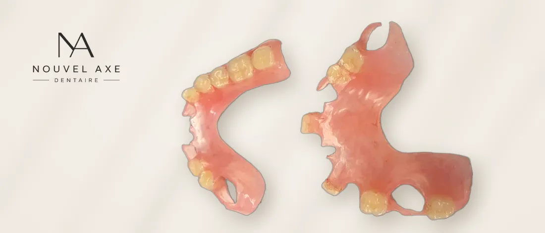 Deux prothèses partielles Valplast